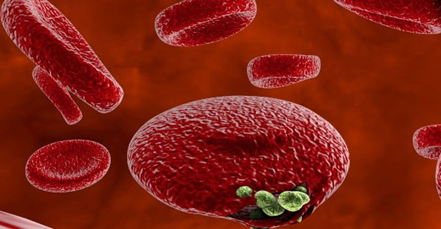 Malaria-blood